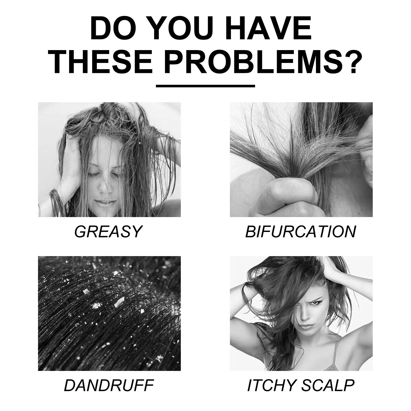 ANTI DANDRUFF SHAMPOO